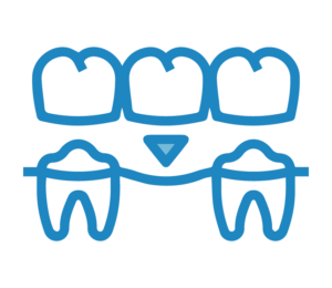 Restorative Dentistry in Kennewick, WA Near Me